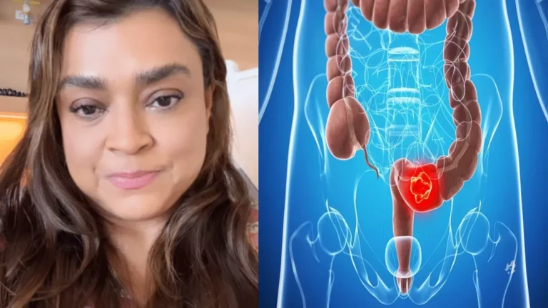 Entenda o que é a cirurgia de amputação do reto