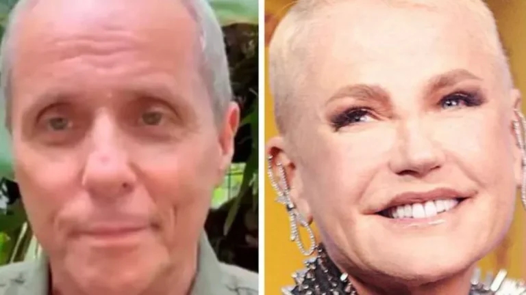 Reencontro de Belo e Gracyanne, saúde de Tony Bellotto e procedimento de Xuxa marcam a semana