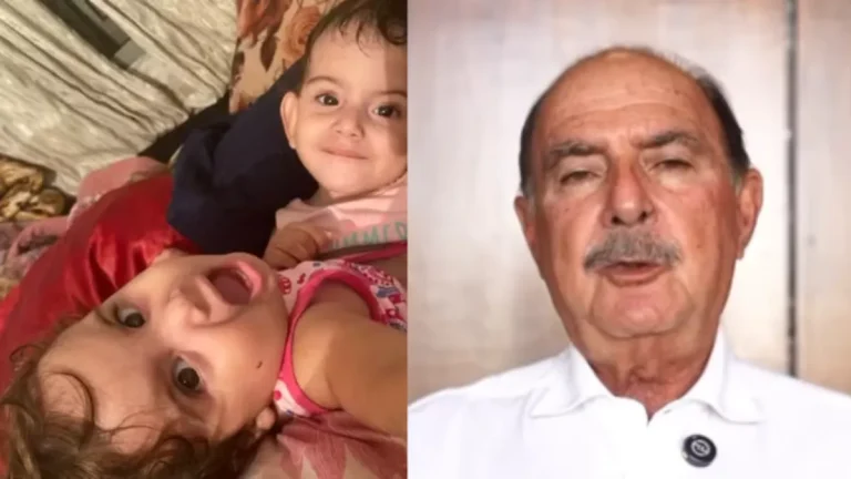 Médico que fez cirurgia de separação lamenta morte de siamesa em Goiás: Doloroso