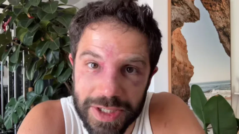 Duda Nagle diz que quebrou o nariz em luta com Popó