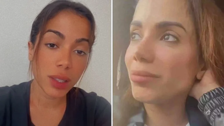 Anitta recebe diagnóstico ‘severo’ de doença e faz desabafo nas redes socias