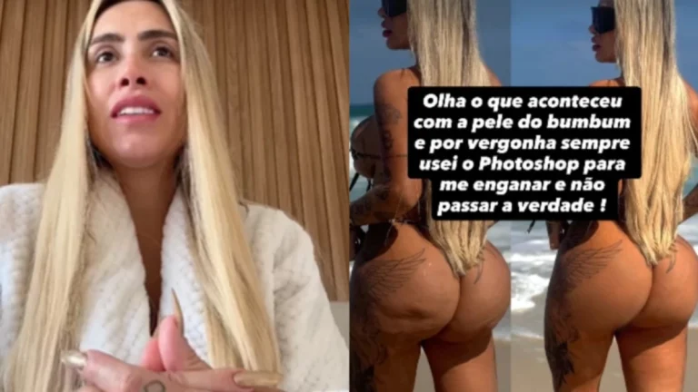 Juju Ferrari é hospitalizada com infecção grave nos glúteos; veja como está