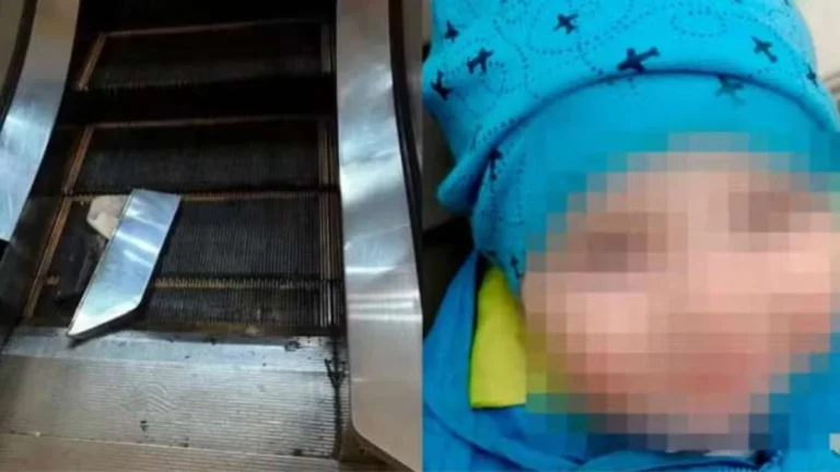 TRAGÉDIA! Braço de criança de 2 anos é arrancado em escada rolante de shopping