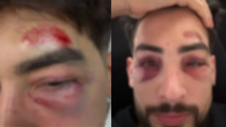 Empresário diz ter sido espancado dentro de famoso bar em SP