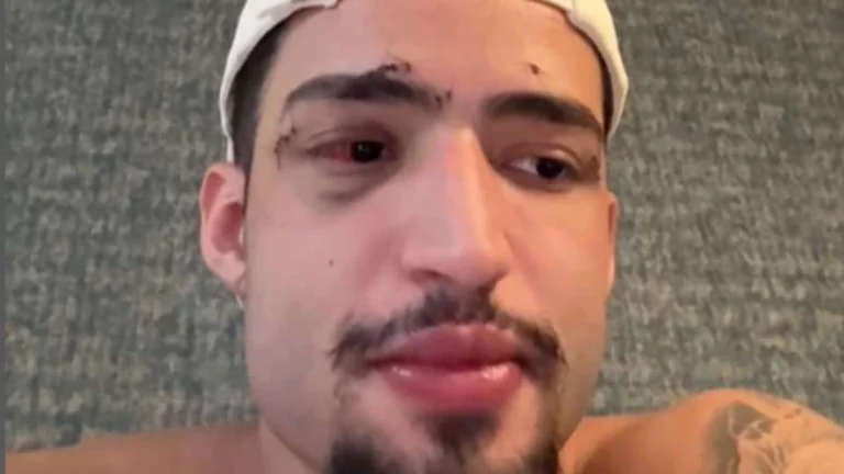 Brasileiro encontrado ao lado de amigo que morreu na Grécia fala pela 1ª vez: Simplesmente apaguei