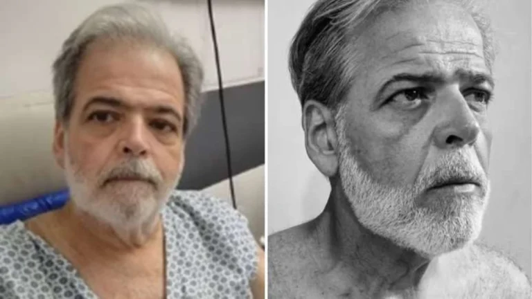 Lembra dele? Ex-Zorra Total, Claudio Cinti revela luta para recuperar peso após internações