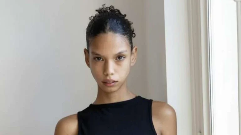 Modelo supera doença e estreia no SPFW: “Sensação única”