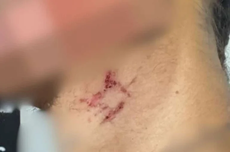 Polícia resgata ‘escravo sexual’ mantido em cárcere cerca de um ano por traficante em GO