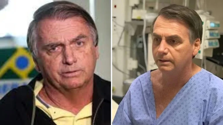 Médico de Bolsonaro abre o jogo e entrega nova atualização sobre estado de saúde do ex-presidente
