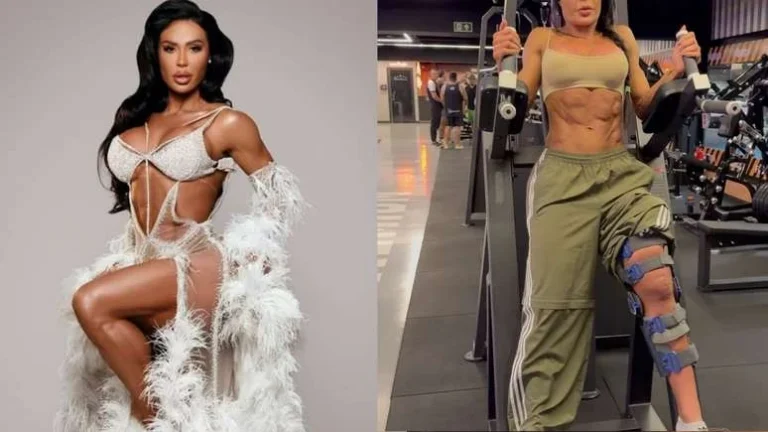 Gracyanne Barbosa responde a comentários sobre cicatriz na perna: “Zero preocupação”