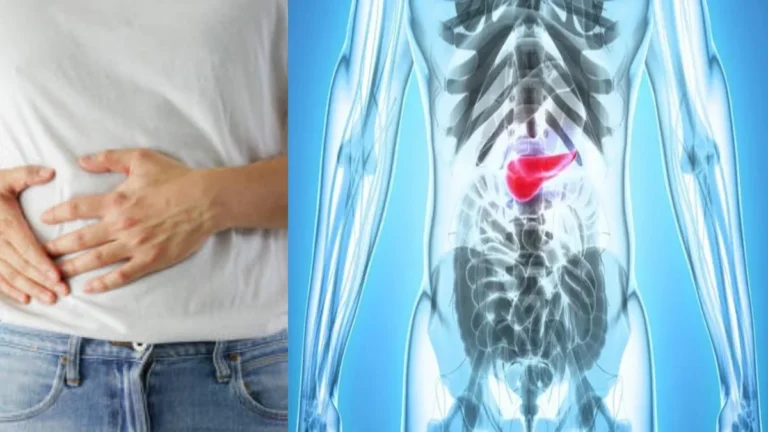 Câncer de pâncreas é detectado em 75% dos casos devido a este sinal; entenda