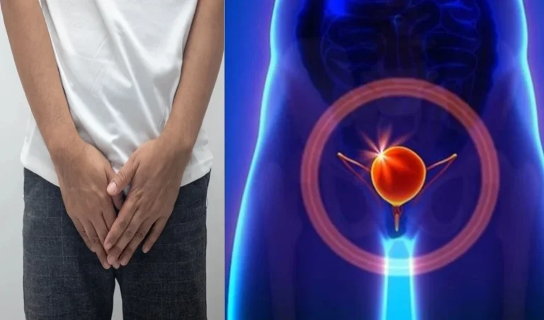 Câncer de bexiga: Conheça as causas e sintomas mais comuns da condição