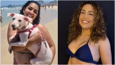 Camila Moura perde 40 kg e faz série de procedimentos; veja antes e depois
