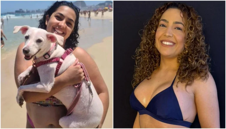 Camila Moura perde 40 kg e faz série de procedimentos; veja antes e depois
