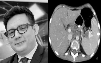 Causa da morte do jornalista Erlan Bastos é finalmente revelada