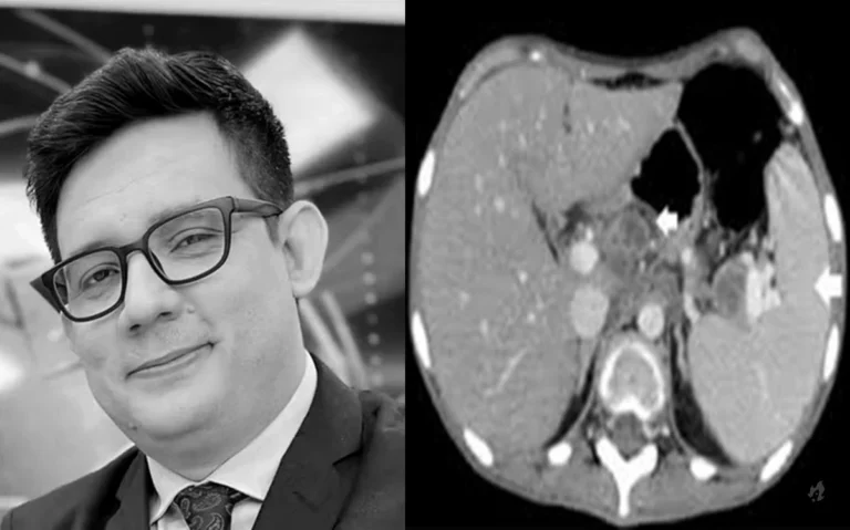 Causa da morte do jornalista Erlan Bastos é finalmente revelada