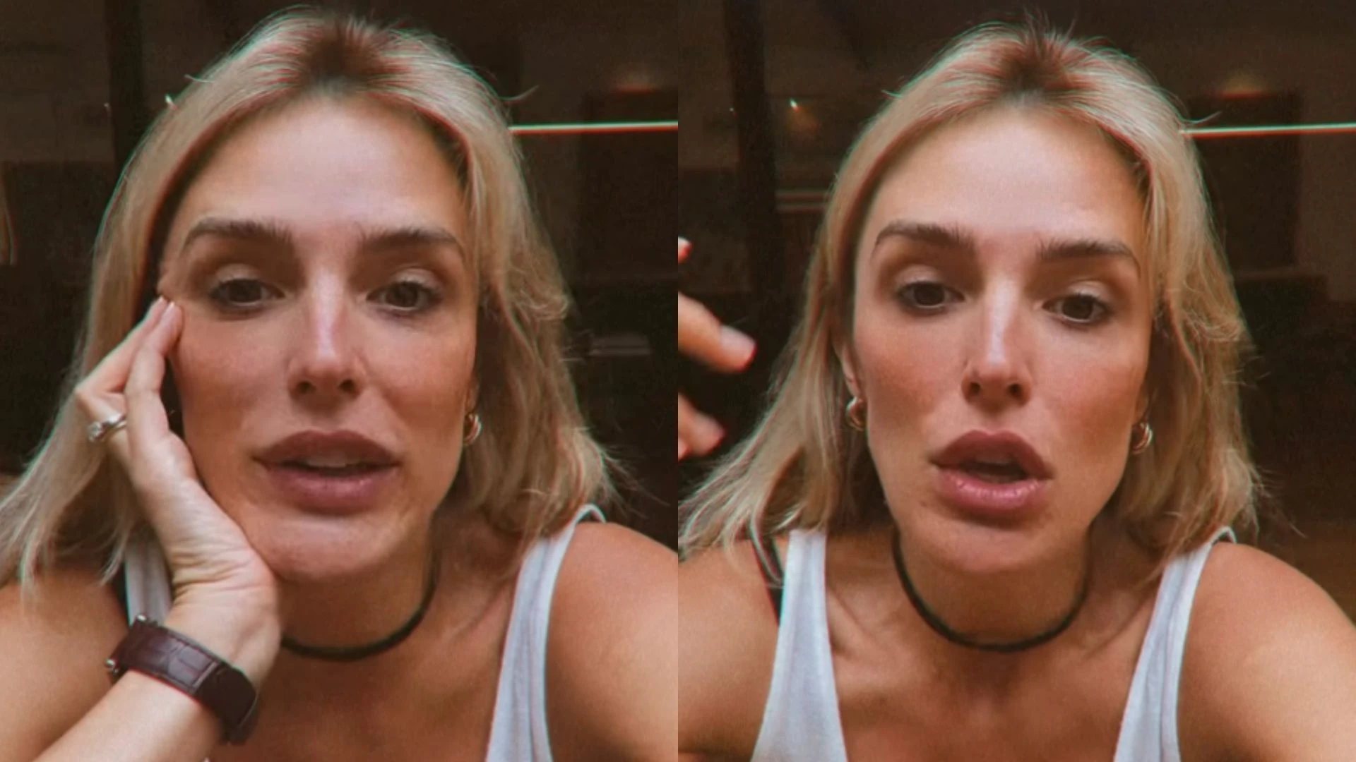 Rafa Brites revela risco de trombose após diagnóstico de lipedema