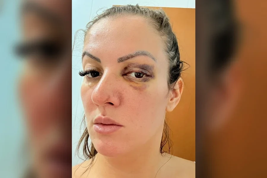 Vereadora que atropelou namorado em SP após agressão se manifesta. Veja vídeo