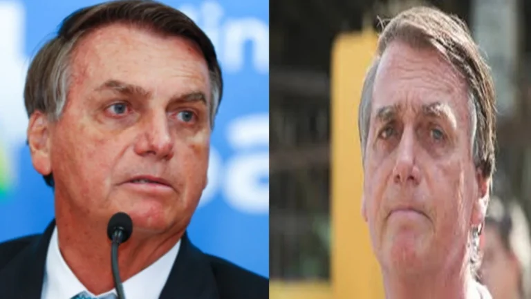 Foi isso que Bolsonaro fez um dia ates de ser encaminhado às pressas para hospital, segundo laudo