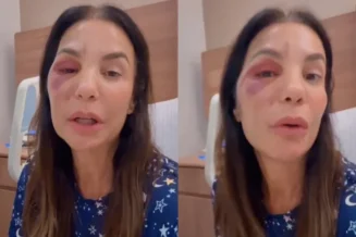 Ivete Sangalo recebe alta hospitalar após cirurgia por fratura na face