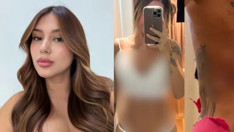 Influencer acusa clínica estética de famosos por sequelas pós-cirurgias