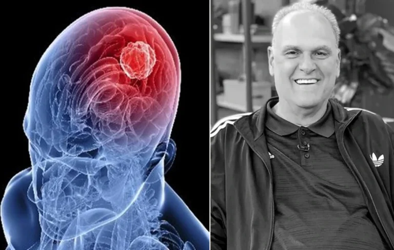 A doença silenciosa que Oscar Schmidt enfrentava desde 2011 e que levou à morte do ídolo