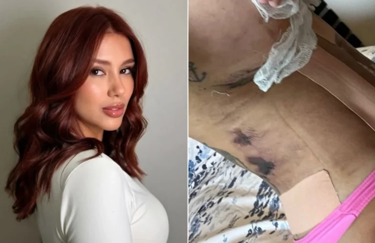Influencer afirma ter sido “deformada” por clínica estética