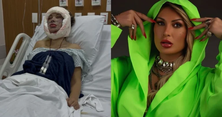 Andressa Urach faz nova cirurgia e afirma que terá rosto novo; confira