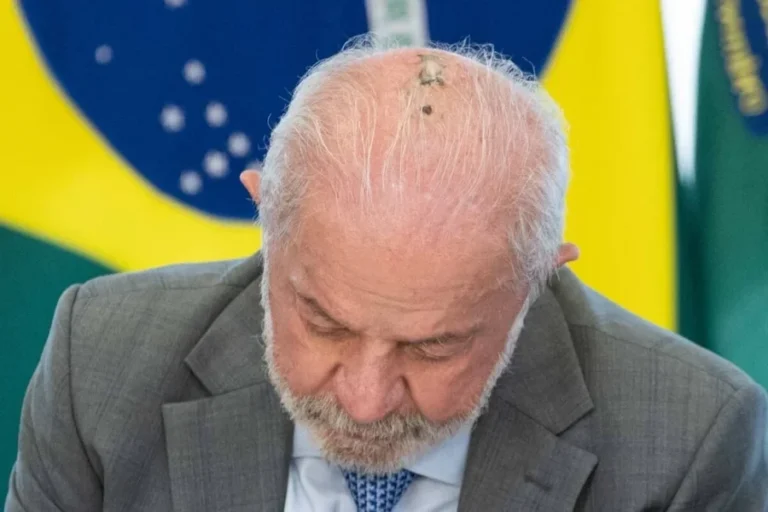 Lula faz novas sessões de radioterapia no couro cabeludo