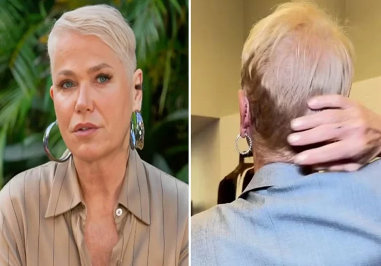 Xuxa Meneghel faz transplante após receber diagnóstico delicado