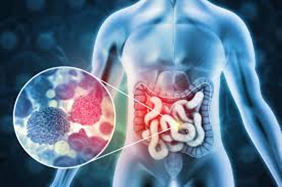 Alimento que você come todo dia foi classificado como altamente cancerígeno