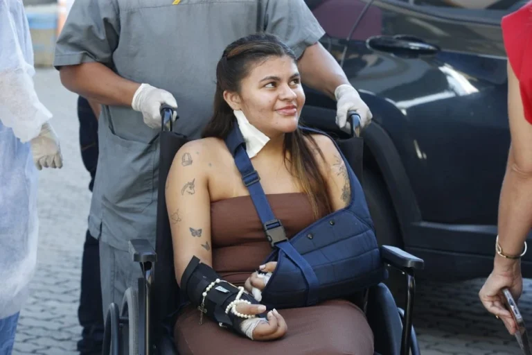 Mulher que teve mãos amputadas pelo ex mostra cicatrizes pela 1ª vez após reimplante: ‘marcas do meu milagre’