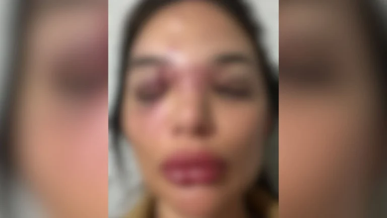 Veja depoimento de mulher agredida por empresário em São Paulo