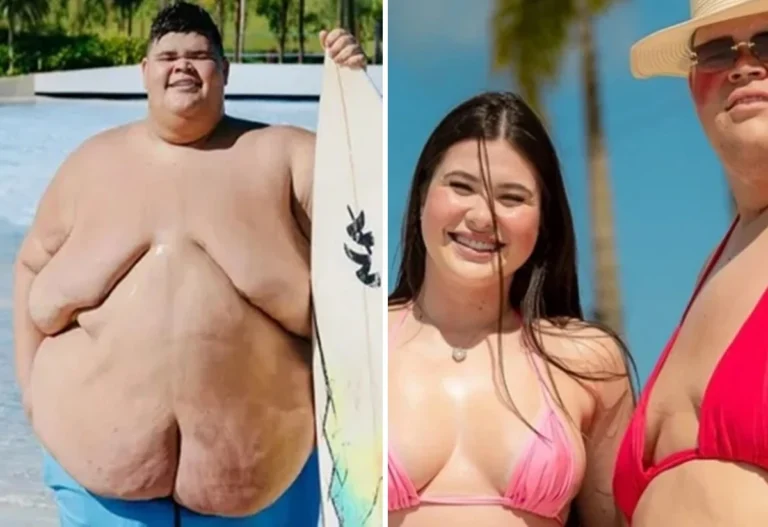 Gordão da XJ surpreende seguidores com novo visual após perder 130 kg