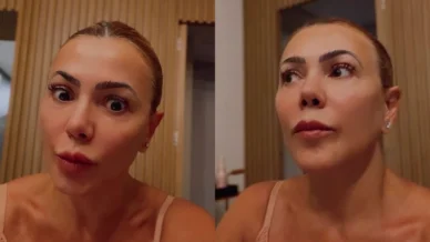 Ex-BBB fala sobre descoberta de cisto no cérebro: 