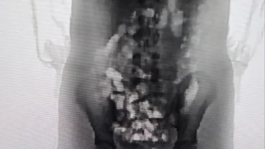 Adolescente tenta entrar em presídio com 32 porções de droga no corpo em SC